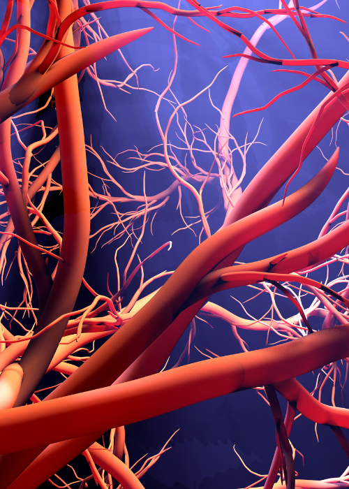 Neurointerventional Radiology